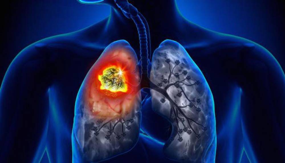 Portland, Oregon: a TOXIC AIR MESS